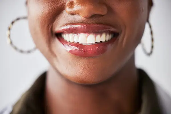 A close-up of a woman’s bright and healthy smile, emphasizing straight white teeth and oral hygiene.