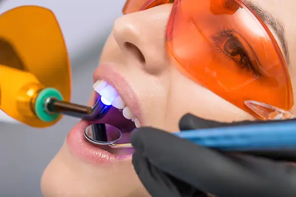 A dentist applying a curing light during a dental bonding procedure while the patient wears protective orange glasses.